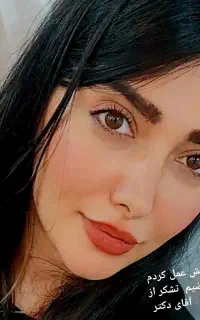 جشنواره جراحی بینی ۳۵ میلیون