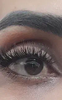 کاشت مژه