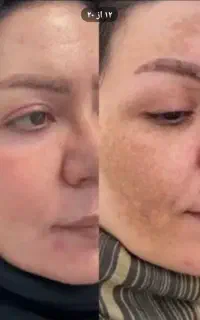 پاک سازی کبدوگوارش