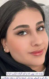 شیدینگ لب و فیبروز ابرو و اسکالپ سر با تکنیک MHA