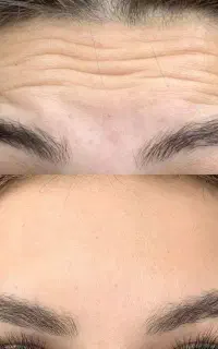 مرکز مجهز زیبایی لیزر تزریق ژل بوتاکس لاغری