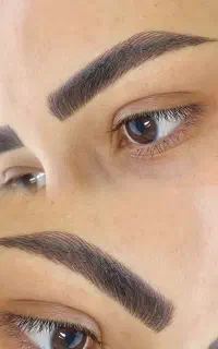 مرکز تخصصی فیبروز ابرو (پیگمنترزهراعبدالملکی)