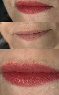 هیراستروک و شیدینگ لب شیما اسکندریان