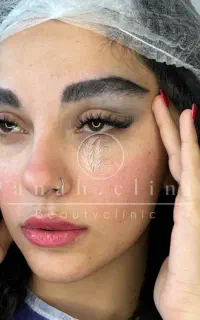 تخفیف ۲۰میلیونی میکروکاشت