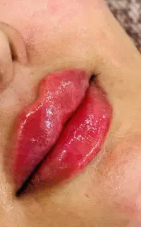 اف آموزش وخدمات ژل بوتاکس کراتین پوست خال
