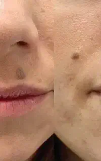 خالبرداری ویژه بانوان با قیمت باورنکردنی