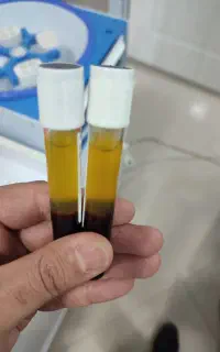 پی آر پی و  پی آر اف بوتاکس و هیر فیلر و مزوتراپی