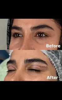 بلفارو فاکس ایز کلینیک مهرزاد