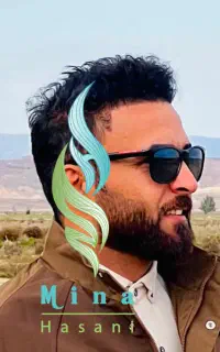 کاشت مو و کاشت ابرو