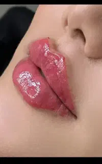 لیفت و فرم دهی صورت با تکنیک‌های روز دنیا