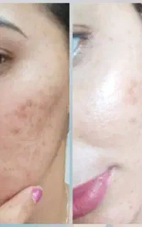کافیه مشکلت رو بگی و بدون بازگشت نمایندگی محصولات