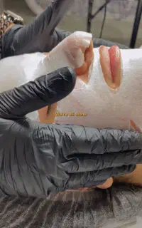خدمات تخصصی پوست در مطب زیبایی نیم بها