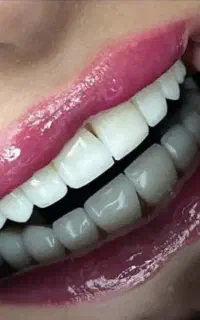 جویایه کار برایه کارورزی دستیار دندانپزشک