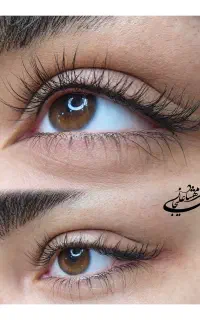 میکروبلیدینگ و شیدینگ (آرایش دائم)