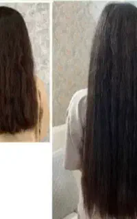 پکیج تضمینی رویش