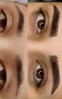 فیبروز ابرو
