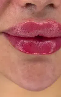 *تخفیف ویژه مدت محدود*