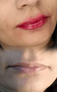 میکروبلیدینگ تخصصی+پیرسینگ ایمن باتخفیف محدود
