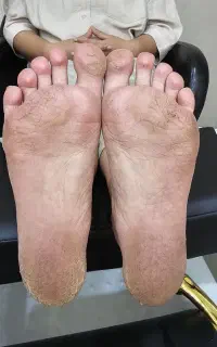 مدل پدیکور درمانی