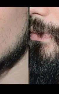 ریش دراوردن کار راحتی شده