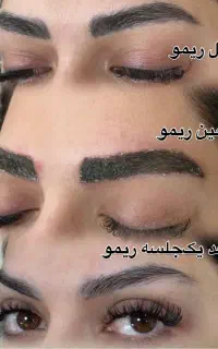 ۵۰٪ تخفیف پاک کردن تتو ، فیبروز ،میکرو، شیدینگ