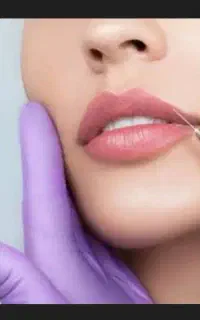 تزریق ژل با کمترین هزینه با کیفت بالا