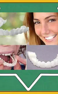 لمینت فوری دندان ترواسمایل اصل (۴ قسط بدون کارمزد)