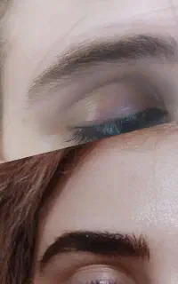 فرصتی ویژه  برای زیبایی دائم