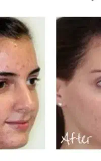 فیشیال تخصصی پاکسازی صورت اقایان و بانوان تخفیف۴۰٪