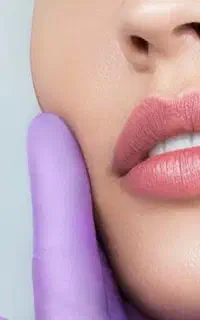 اف ویژهه فیلر و بوتاکس