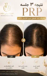 کلینیک زیبایی و مرکز لیزر دژآباد در رودسر