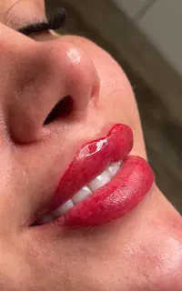 تخفیف آموزش فیبروز و خط چشم. و زدن فیبروز
