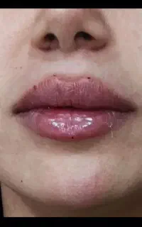 مطب زیبایی دکتر پاک منش ،ژل و بوتاکس و لیزر