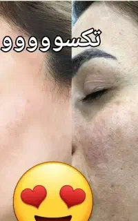 مث برف شو