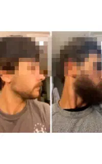 میدونستی دارو پرپشتی ریش اومده