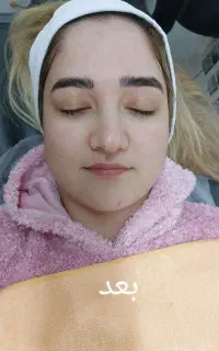 فشیال و پاکسازی تخصصی پوست