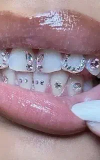 کلینیک آریسابیوتی( تمامی خدمات زیر ۱ میلیون)