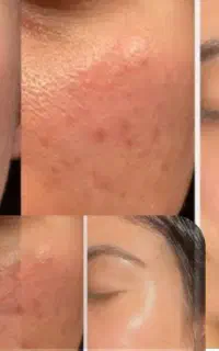 پاکسازی پوست