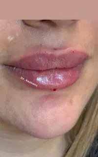 کلینیک زیبایی رز سفید(اقساط‌نیک‌کارت،اسنپ‌پی،دیجی‌
