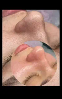 پاکسازی صورت با مواد کاملا گیاهی و بدون سرب