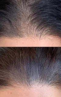 شامپو تقویت‌کننده و ضد ریزش مو