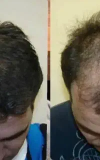دیگه نیازبه کاشت نداری