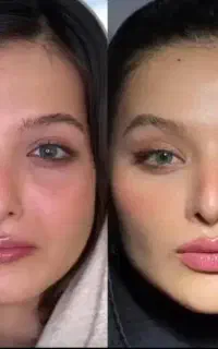 ژل یک سی سی فقط ۲۲۰۰