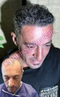 معجزه مووی سر توسط شیرازی در تبریز