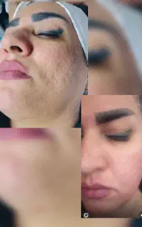 مرکز لیزر و زیبایی الفا