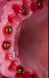 اوردنچر دبل جوانان هرپایه ۸۵۰۰