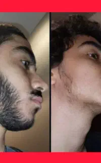 تیغ زدن صورت ممنوع