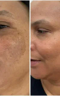 کرم معجزه روشنکننده قویt450
