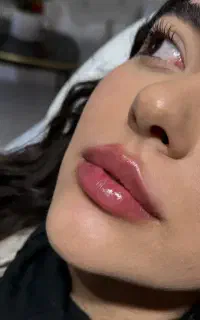 فیلر بوتاکس مزو پی ار پی لیزر فیشال کلینیک زیبایی