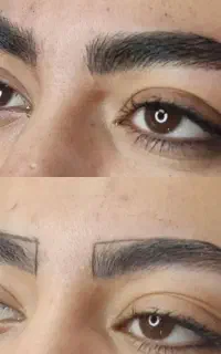 فیبروز ابرو